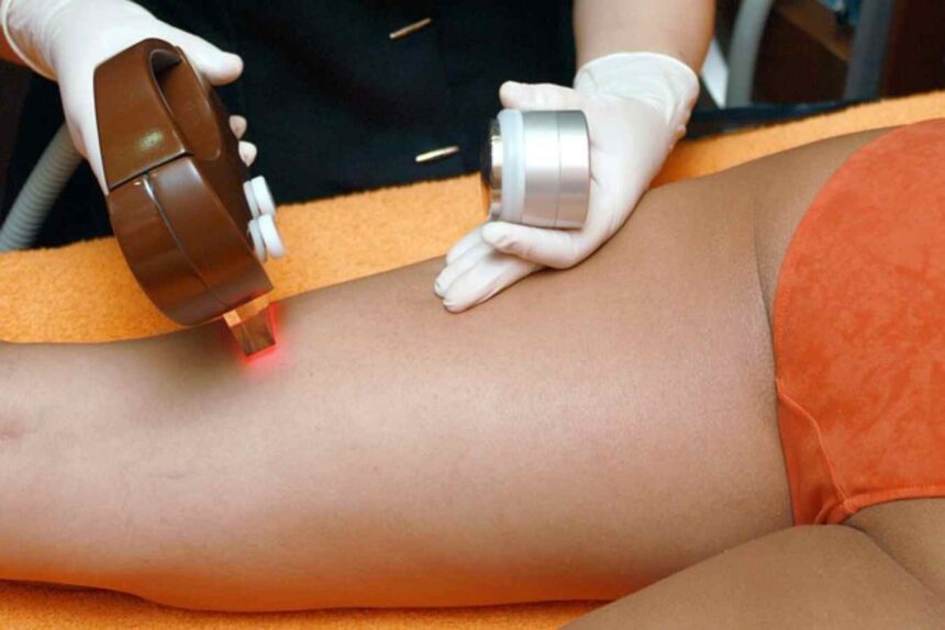 hair removal 4188610 640 1 Jaki salon kosmetologiczny warto wybrać?